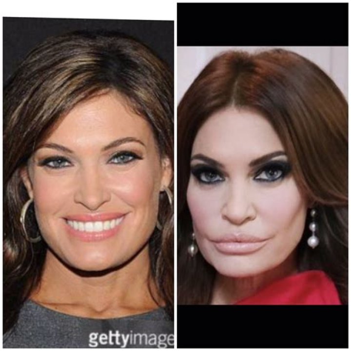 Unveiling The Transformation: Guilfoyle Plastic Surgery