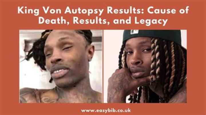 Witness The Tragic Aftermath: King Von Autopsy Photos [WARNING: Graphic]